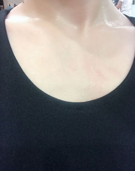 溶尸奇案